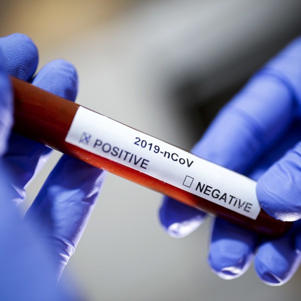 Tres médicos dan positivo a Coronavirus en el país