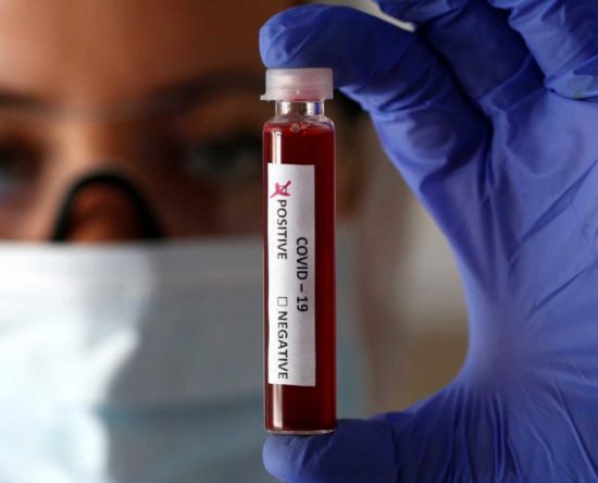 Pruebas de Coronavirus costará RD$4,300 en laboratorios privados