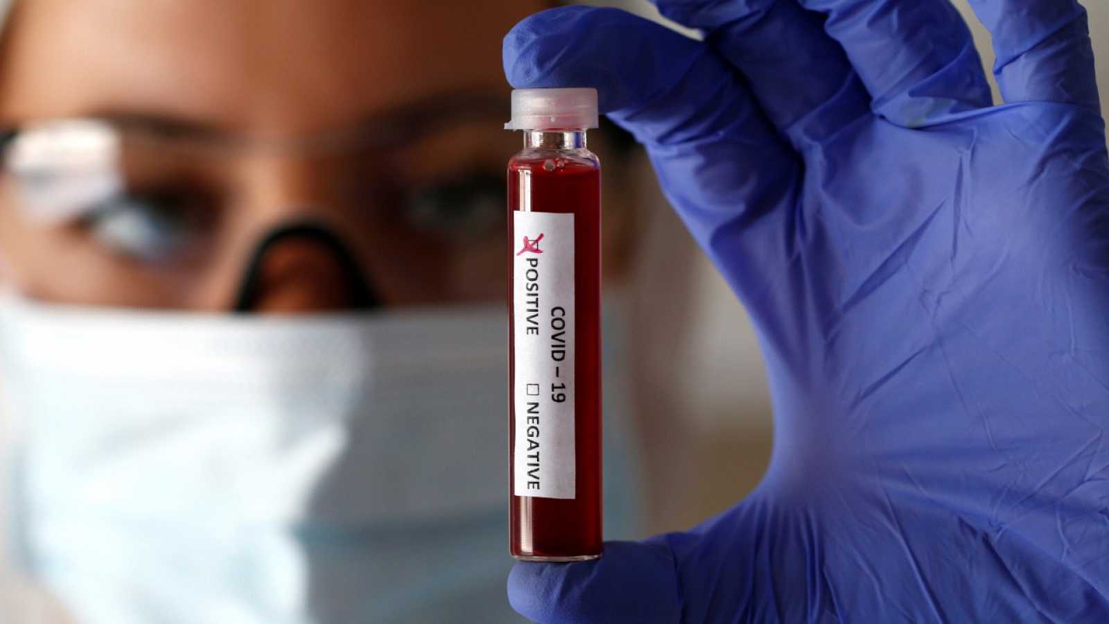 Pruebas de Coronavirus costará RD$4,300 en laboratorios privados