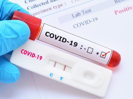 Al menos 952 contagios por covid se registran en RD; cinco hospitalizaciones