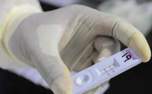 Pruebas antigénicas de Covid serán comercializadas en farmacias