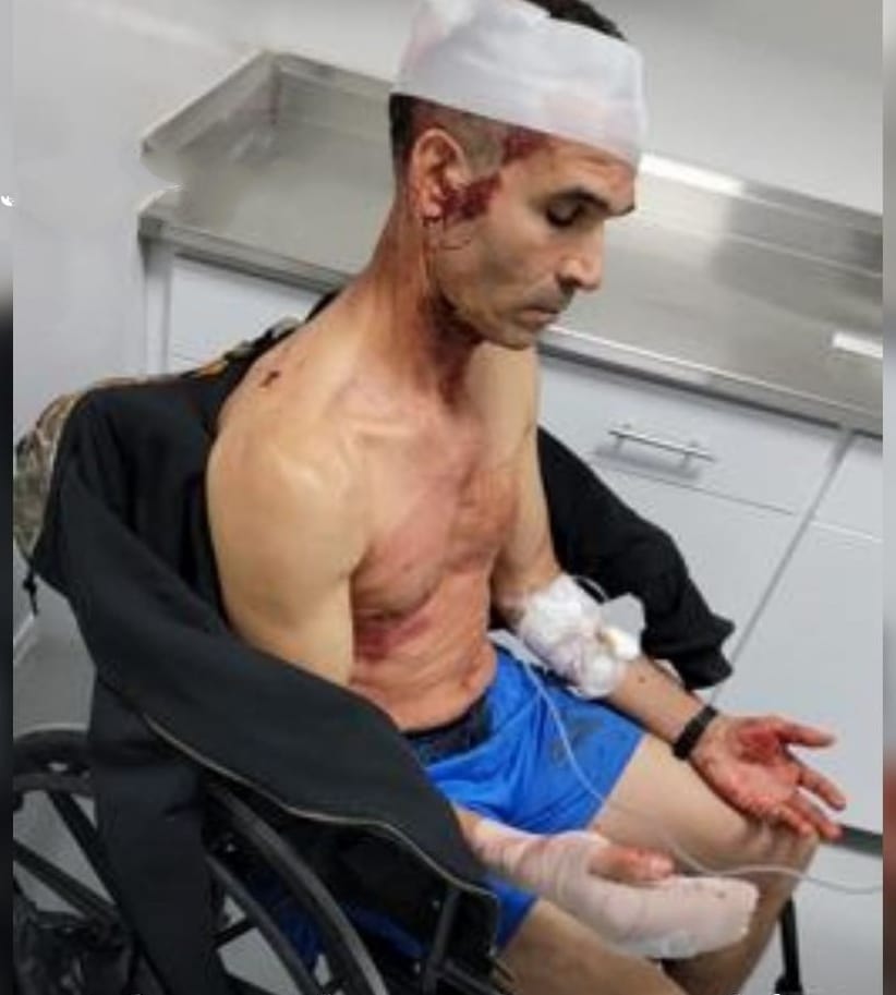 Atleta Pedro Guzmán fue asaltado y herido con machete en Boca Chica