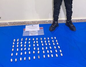 Detienen nigeriano que pretendía viajar a Francia con el estomágo lleno de cocaína